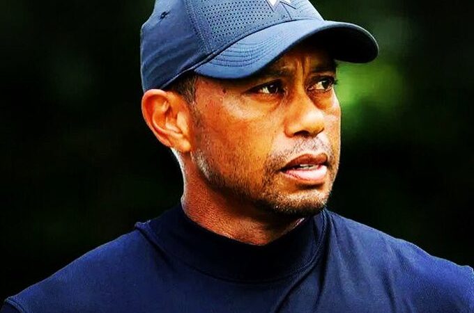 Tiger Woods sufrió de varias lesiones luego de su accidente